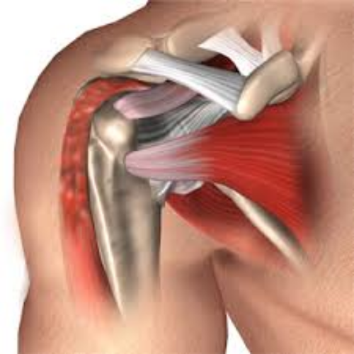 biceps-tendinitis-treatment-hyderabad